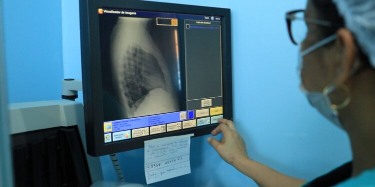 Com Intervenção da Prefeitura, raio-X da UPA Leste retoma funcionamento em Porto Velho