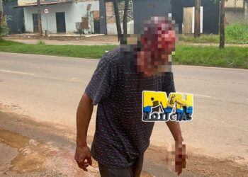 URGENTE: “Barbudo” é atacado a golpes de enxada por marido enciumado na zona leste