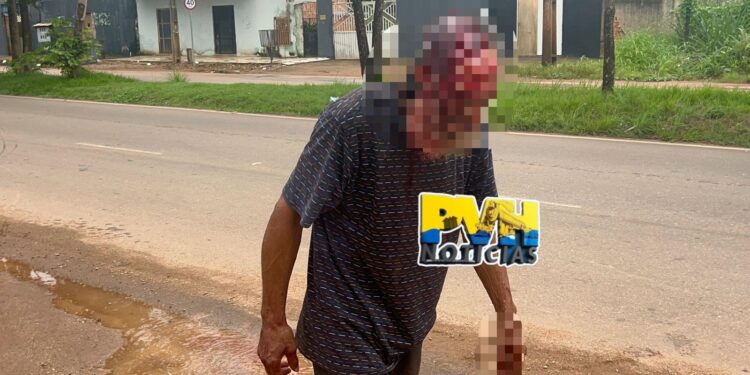 URGENTE: “Barbudo” é atacado a golpes de enxada por marido enciumado na zona leste