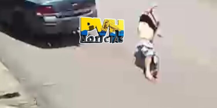 VÍDEO: Motociclista sofre fratura exposta em colisão de frente com carro