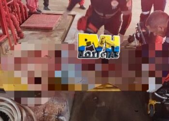 DEU RUIM: Apenado corta a tornozeleira e a mão após tentar invadir casa da Ex