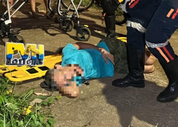 URGENTE: Motociclista atropela ciclista e foge sem prestar socorro no Embratel