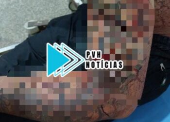 SÓ MEU: Jovem é atacado após negar ter relação com aniversariante em festa na capital