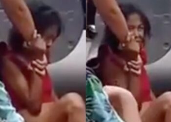 CENAS FORTES: Mulher chora e delira de dor após ser atropelada por caminhão; veja vídeo