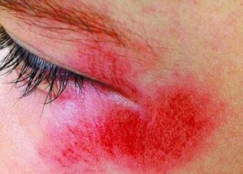 Bandidos usam chave de roda para agredir e assaltar funcionário do IG em Porto Velho