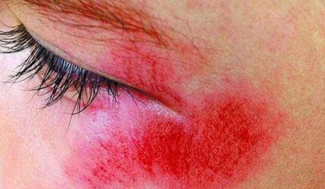 Bandidos usam chave de roda para agredir e assaltar funcionário do IG em Porto Velho