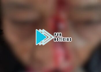 URGENTE: Idosa tem rosto desfigurado após ataque de cachorro na zona leste