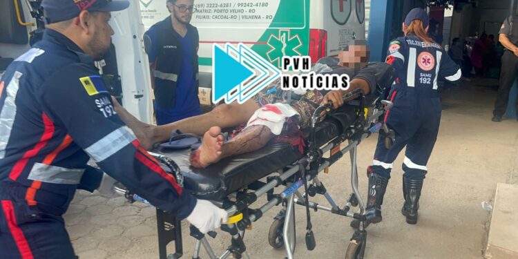 NO JOELHO: Homem é atingido por motossera durante trabalho em chácara na BR-319