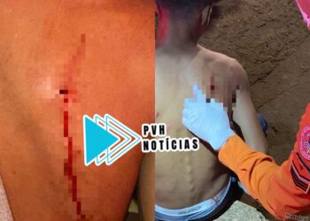 NAS COSTAS: Jovem é esfaqueado durante briga em vila de apartamentos na capital