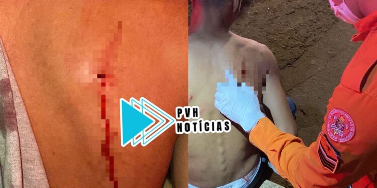 NAS COSTAS: Jovem é esfaqueado durante briga em vila de apartamentos na capital