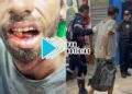 URGENTE: Homem tem mandíbula quebrada durante espancamento a pauladas na zona sul