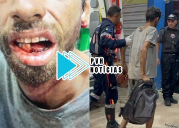 URGENTE: Homem tem mandíbula quebrada durante espancamento a pauladas na zona sul