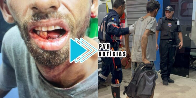 URGENTE: Homem tem mandíbula quebrada durante espancamento a pauladas na zona sul