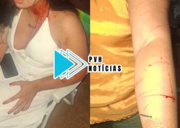 SEIS PONTOS: Adolescente é agredida com perna-manca na cabeça pela madrasta evangélica depois de ganhar garrafa de vinho