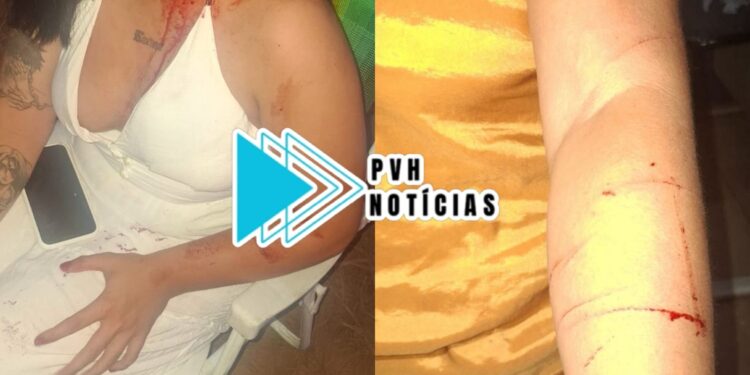 SEIS PONTOS: Adolescente é agredida com perna-manca na cabeça pela madrasta evangélica depois de ganhar garrafa de vinho