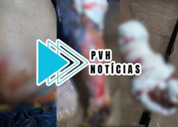 VÁRIOS GOLPES: Homem é atacado a facadas durante confusão em bar