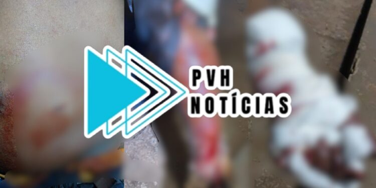 VÁRIOS GOLPES: Homem é atacado a facadas durante confusão em bar