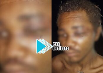CÁRCERE: Morador de rua acusado de furto é sequestrado e espancado por criminosos em Porto Velho