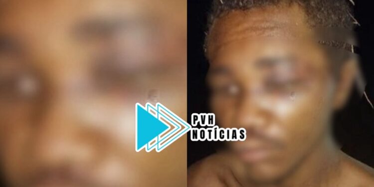 CÁRCERE: Morador de rua acusado de furto é sequestrado e espancado por criminosos em Porto Velho