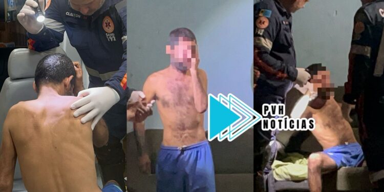 URGENTE: Homem é atacado com paulada na cabeça na zona leste