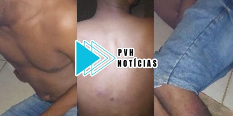 LEI DO SILÊNCIO: Jovem é espancado por bando no residencial Orgulho do Madeira