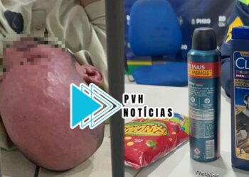 INUSITADO: Homem careca é preso furtando shampoo anti-caspa em supermercado