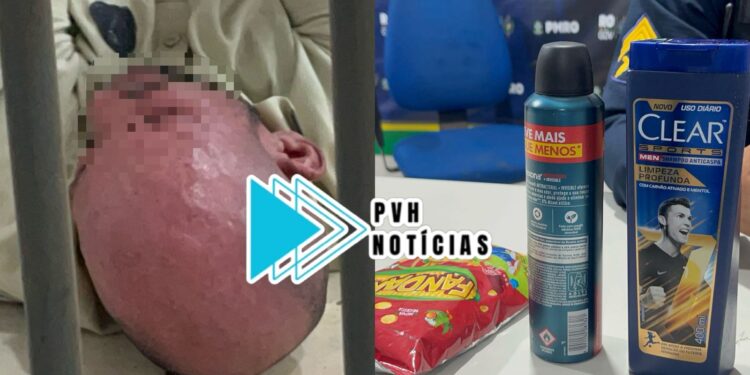 INUSITADO: Homem careca é preso furtando shampoo anti-caspa em supermercado