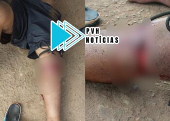 URGENTE: Homem é atacado a golpes de facão por Venezuelano na zona leste