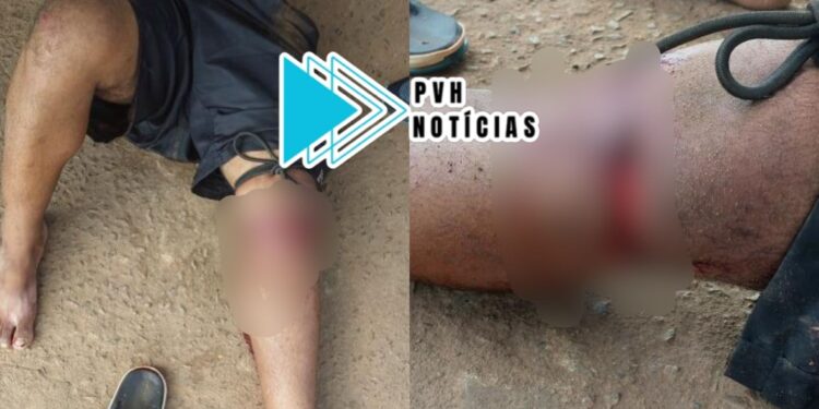 URGENTE: Homem é atacado a golpes de facão por Venezuelano na zona leste