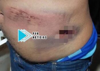 VIOLÊNCIA: Homem é agredido a pauladas e tem casa invadida por sobrinhos da esposa