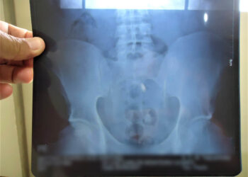 NO 470: Mulheres são flagradas entrando com drogas em penitenciária da capital