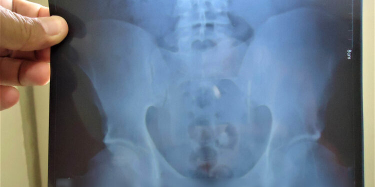 NO 470: Mulheres são flagradas entrando com drogas em penitenciária da capital