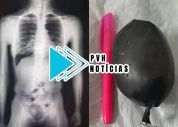 NA “LARICINHA”: Mulher é presa entrando com drogas nas partes íntimas em presídio da capital