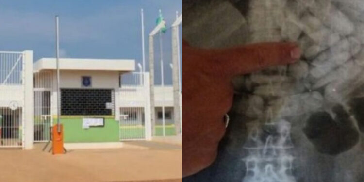 NO 603: Mãe é presa levando droga no estômago para filho presidiário