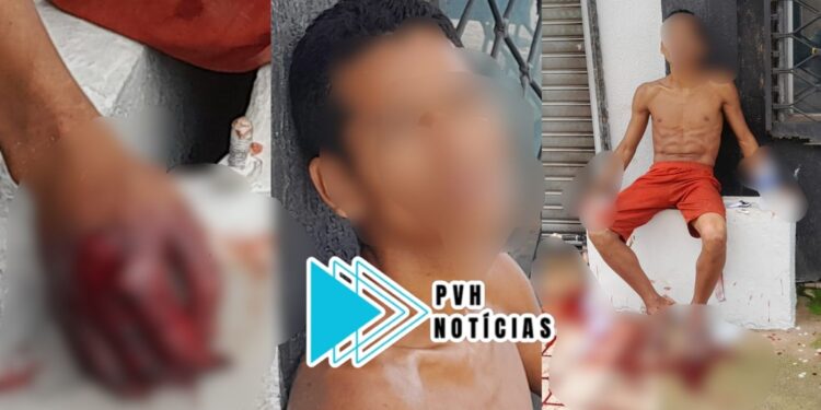 URGENTE: Jovem pede ajuda após ser baleado no centro de Porto Velho