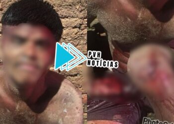 DEU RUIM: Apenado tem dedos da mão cortados com facão durante furto em vila de apartamentos