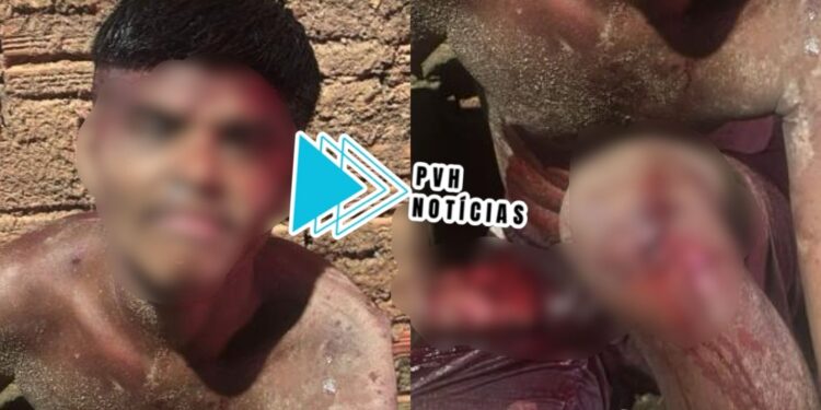 DEU RUIM: Apenado tem dedos da mão cortados com facão durante furto em vila de apartamentos