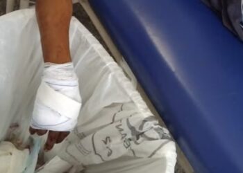 ATUALIZADA: Homem é baleado por criminosos de moto na zona leste