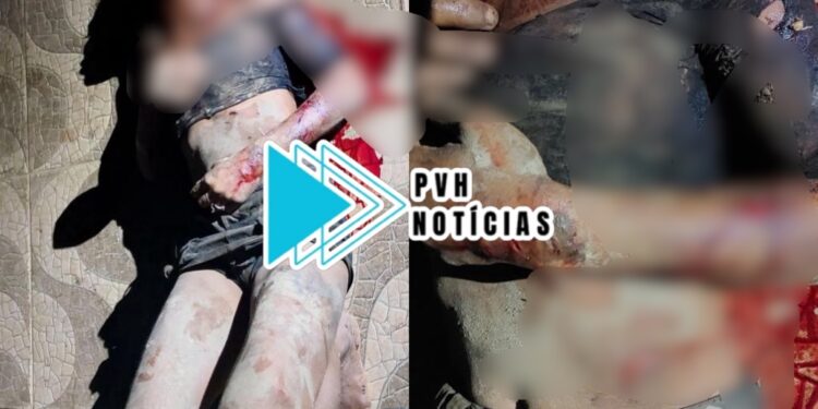 VÁRIOS GOLPES: Mulher sofre ataque a facadas no Triângulo