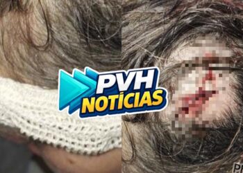 NA CABEÇA: Mulher é atacada com golpe de facão pelo marido em condomínio