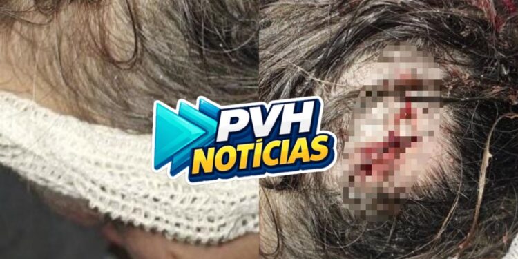 NA CABEÇA: Mulher é atacada com golpe de facão pelo marido em condomínio