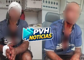 ESPANCADO: Homem diz que foi agredido durante roubo na zona leste e só acordou no centro