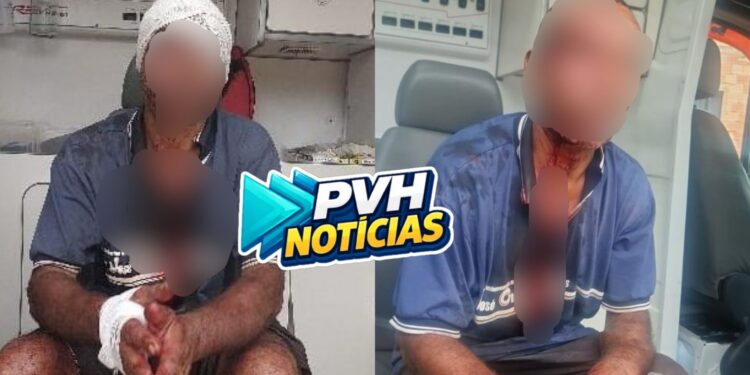 ESPANCADO: Homem diz que foi agredido durante roubo na zona leste e só acordou no centro
