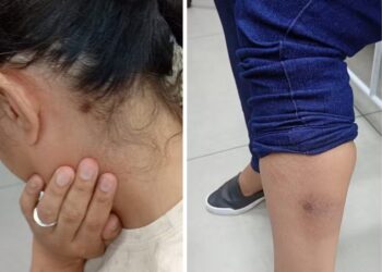 Mulher é resgatada pela PM após ser mantida em cárcere privado pelo ex-marido em Ro
