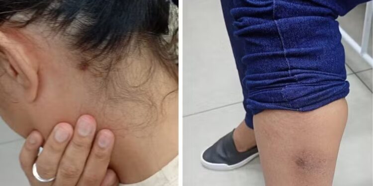 Mulher é resgatada pela PM após ser mantida em cárcere privado pelo ex-marido em Ro