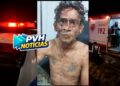 NA CABEÇA: Homem é atacado a golpes de facão enquanto trabalhava na BR-319