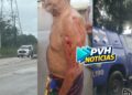 URGENTE: Idoso é atacado a facadas pelo Ex-enteado em Porto Velho