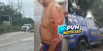 URGENTE: Idoso é atacado a facadas pelo Ex-enteado em Porto Velho