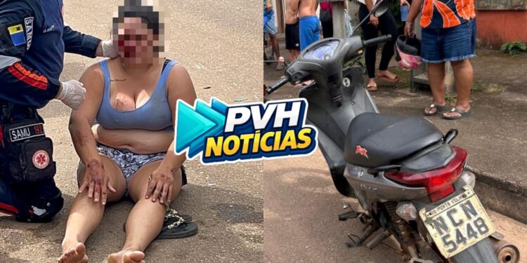 URGENTE: Motociclista fica desmaiada apôs passar em lombada e cair na zona sul