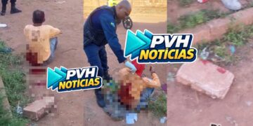 URGENTE: Funcionário da Madecon é atacado a facada e pedradas pelo enteado na zona leste